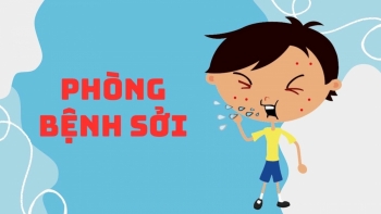 Hà Nội: Gia tăng bệnh nhân nhập viện do mắc bệnh sởi và sốt xuất huyết