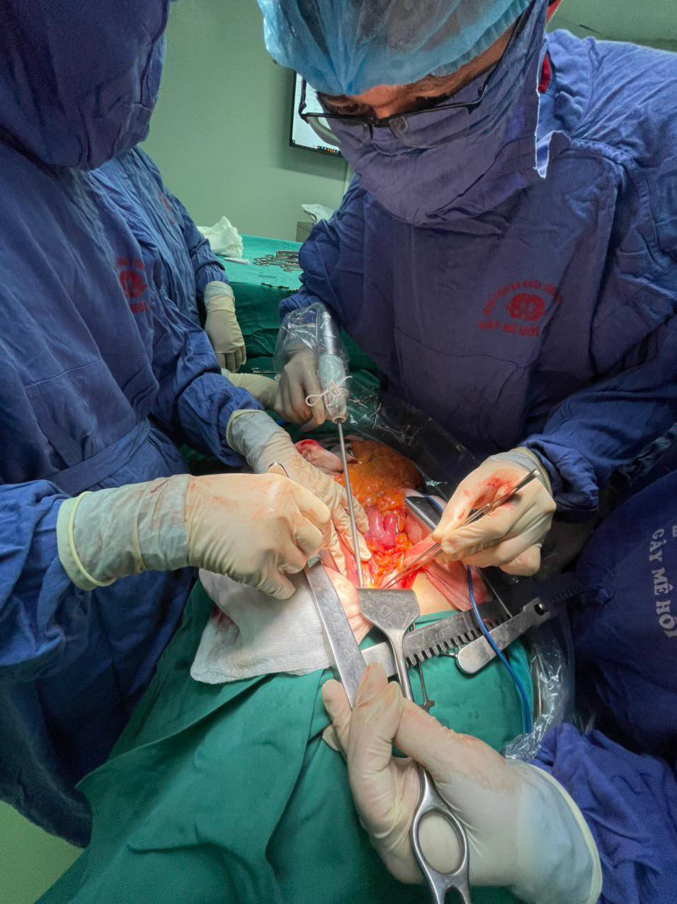 Bệnh viện đa khoa tỉnh Phú Thọ: Ứng dụng dao siêu âm trong phẫu thuật